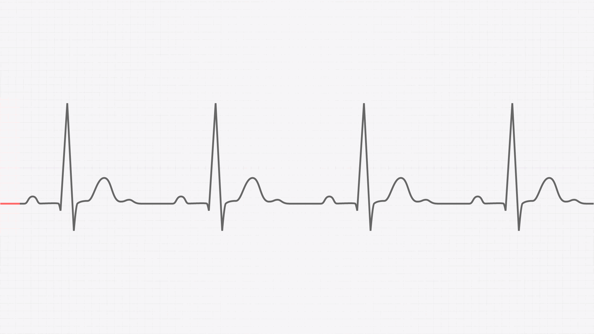 REDLINE EKG ELEKTROD